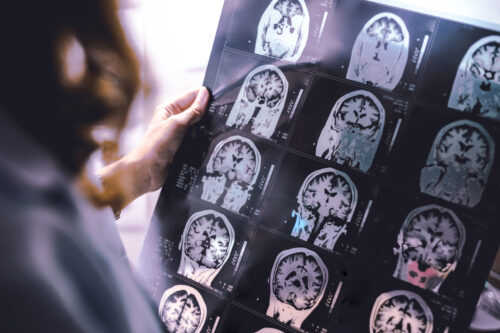 examining brain scans